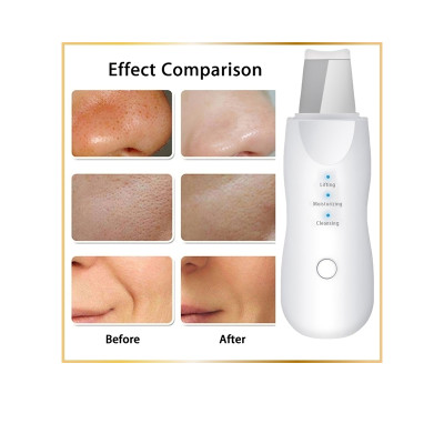 FamilyStore | Appareil Visage 3-en-1 – Nettoyage, Hydratation et Purification